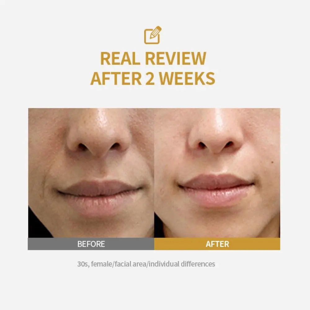 Instant Lifting & Firming Serum — Visible Results in 7 Days