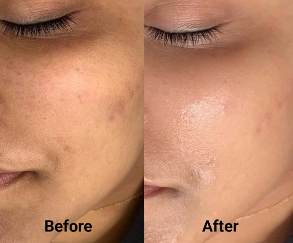 Korean Wrinkle Bounce Multi Balm Stick