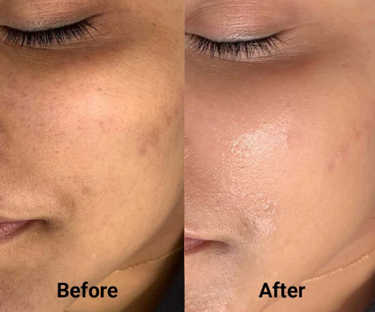 Korean Wrinkle Bounce Multi Balm Stick